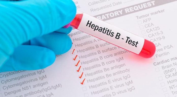 hepatitis-b:-alertan-que-la-mayoria-de-los-que-la-padecen-no-lo-saben